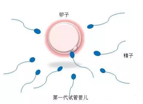关于景泰生殖